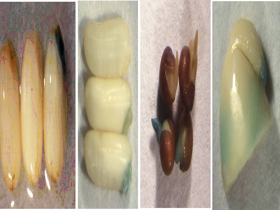 Transient GUS Gene Expression